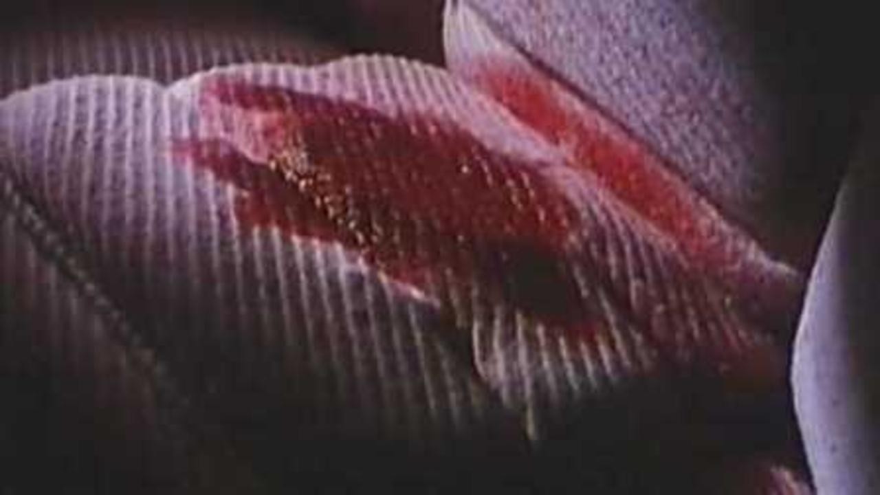 Blood Stains in a New Car