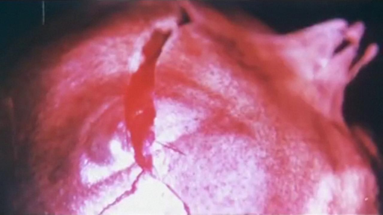 Variations on a Pomegranate