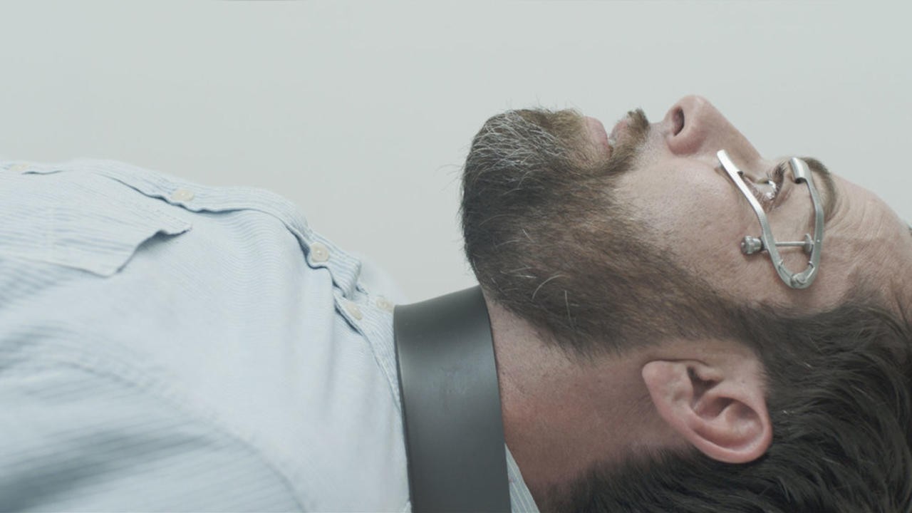 The Procedure