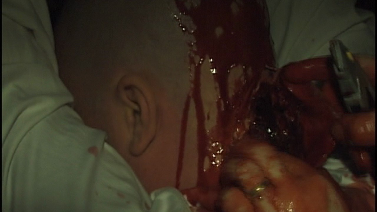 Fetus (Hard Splasher)