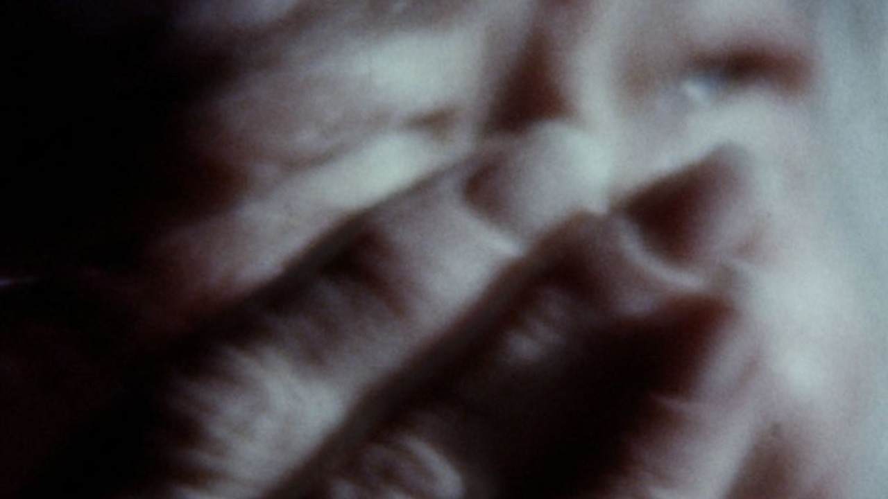 An Anatomy of Melancholy