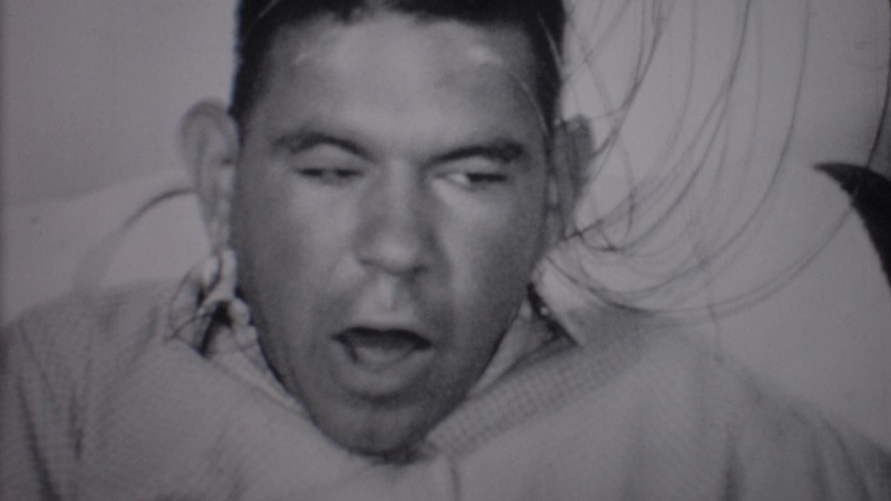 Epileptic Seizure Comparison