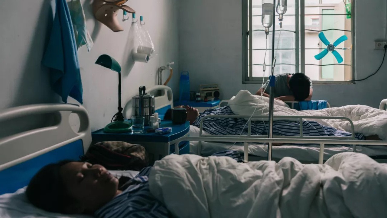 Hypersomnia