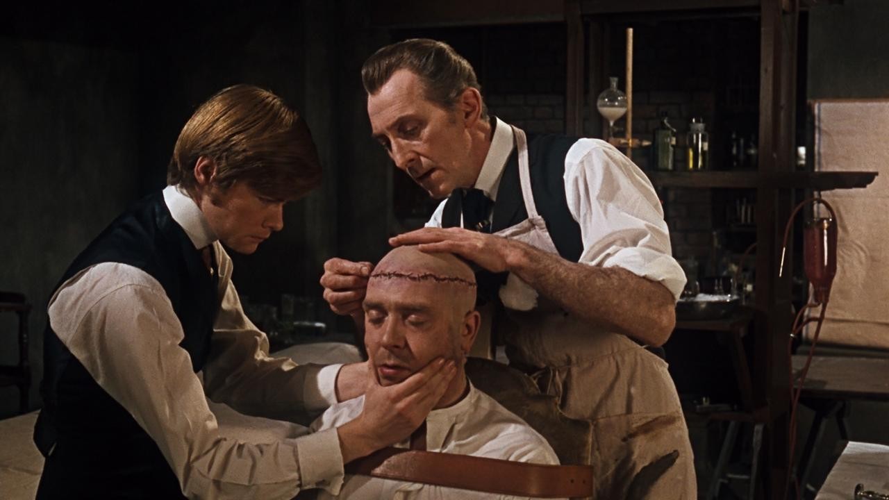 El cerebro de Frankenstein