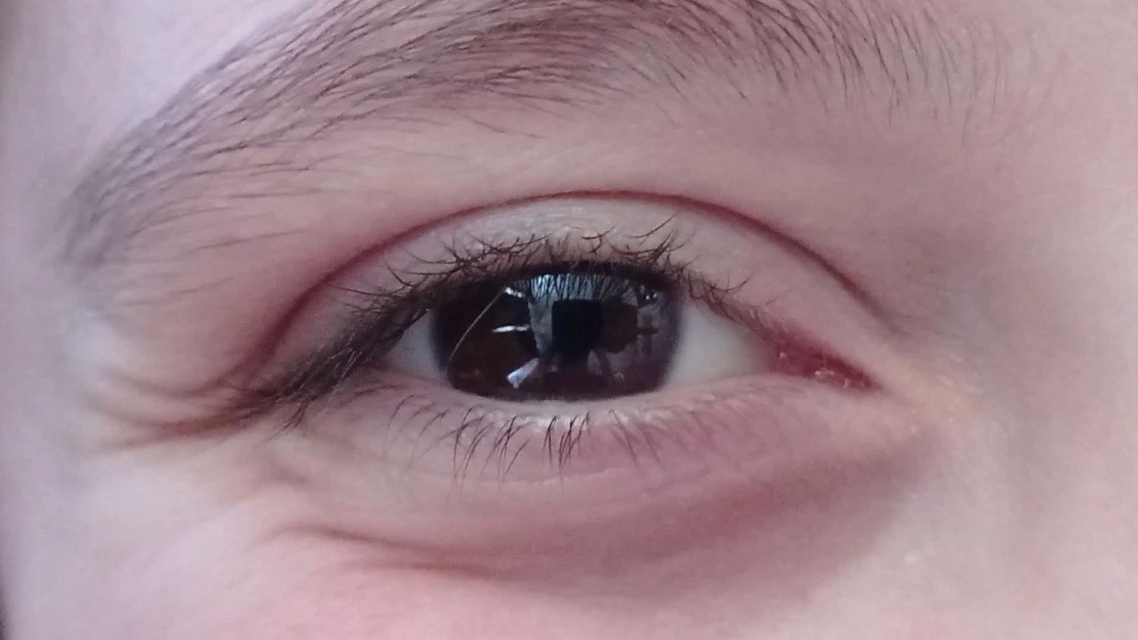 Ojo