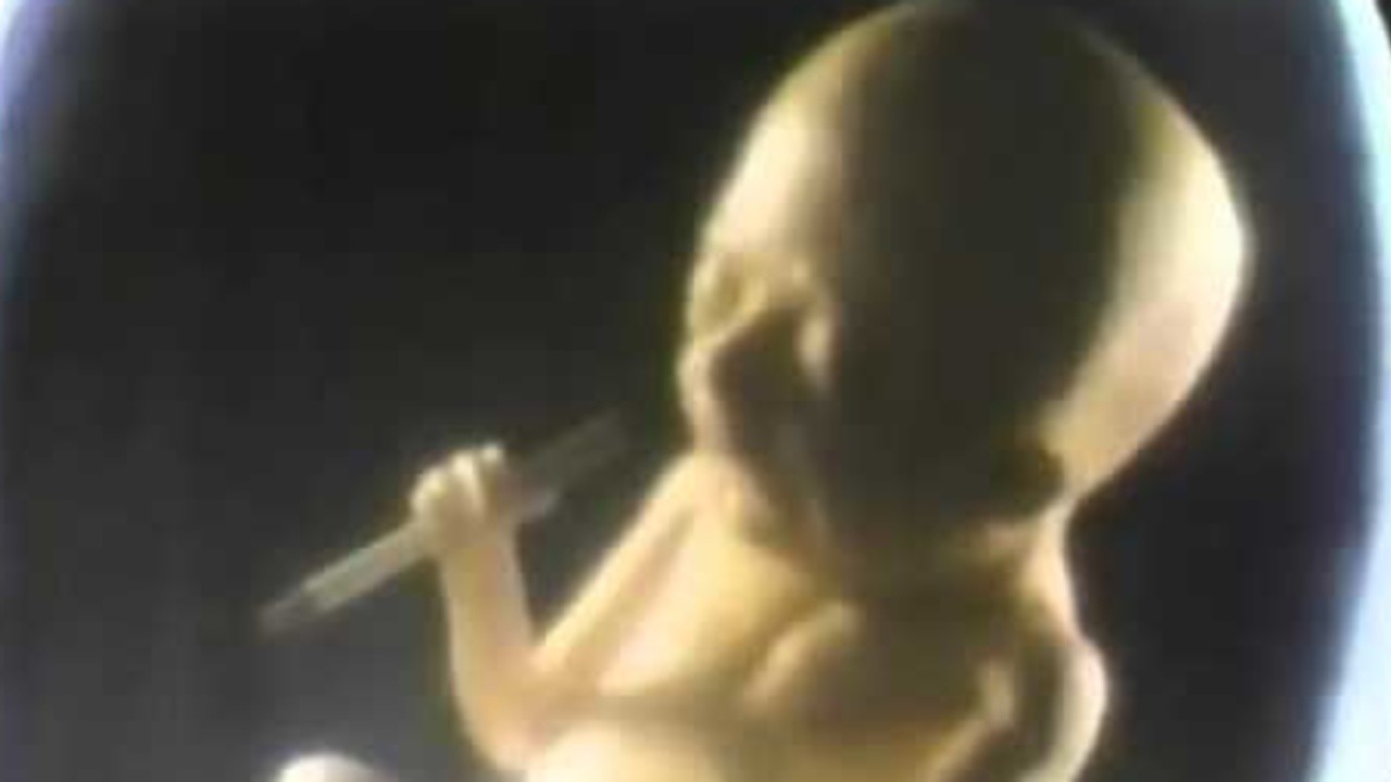 fetus smoking a cigarette The American Cancer Society: Smoking Fetus (1985)