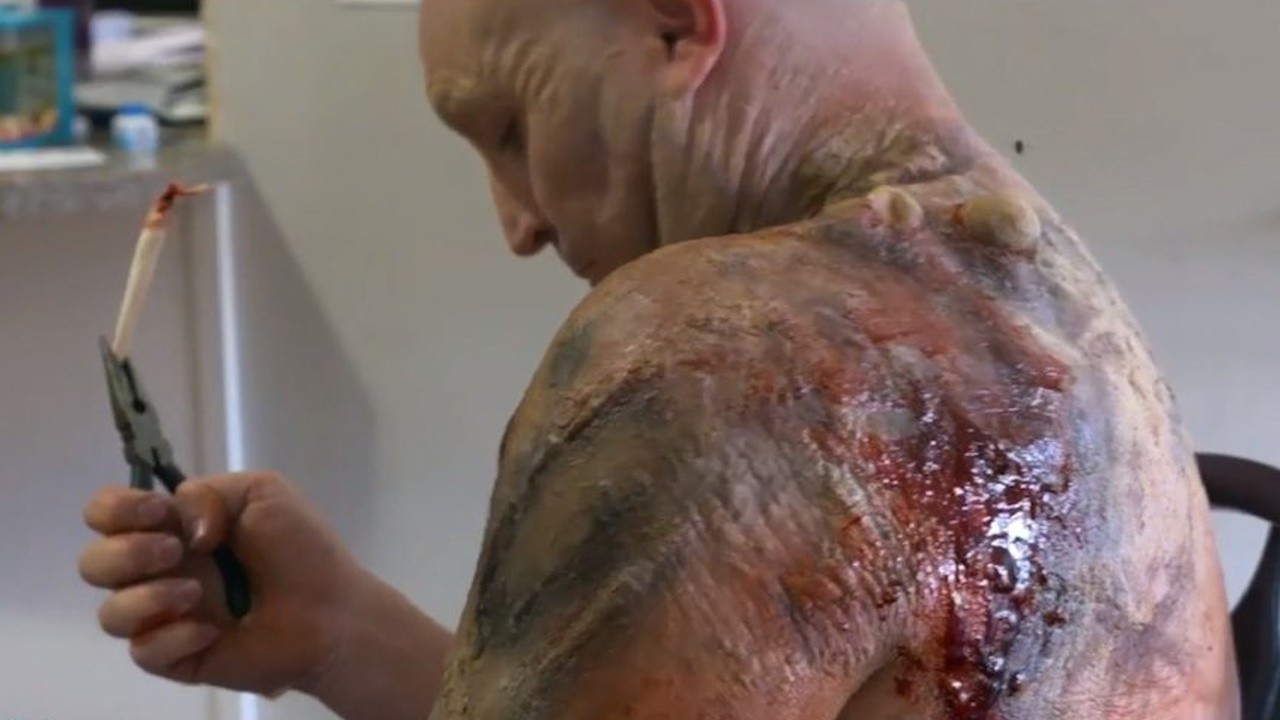 The Infection