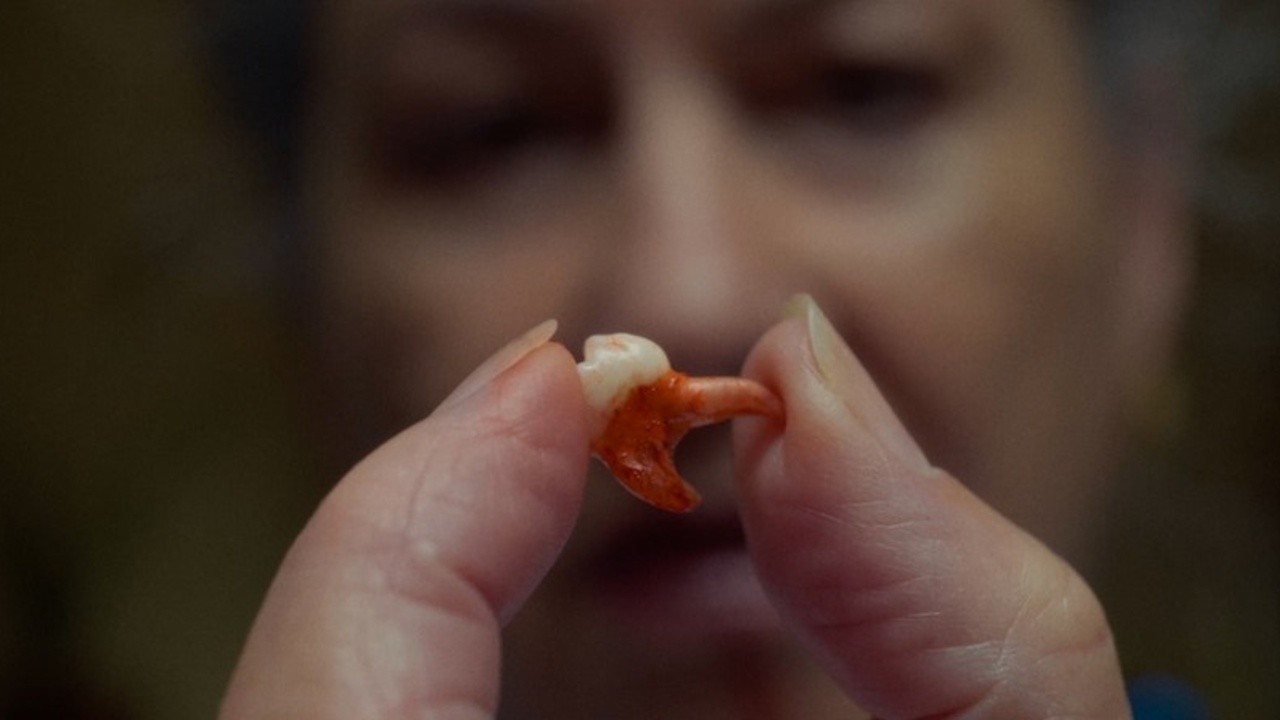 Tooth