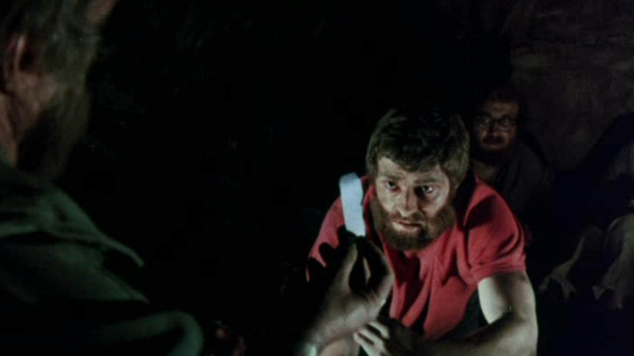 The Severed Arm