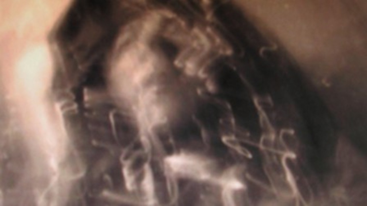 La prière genital
