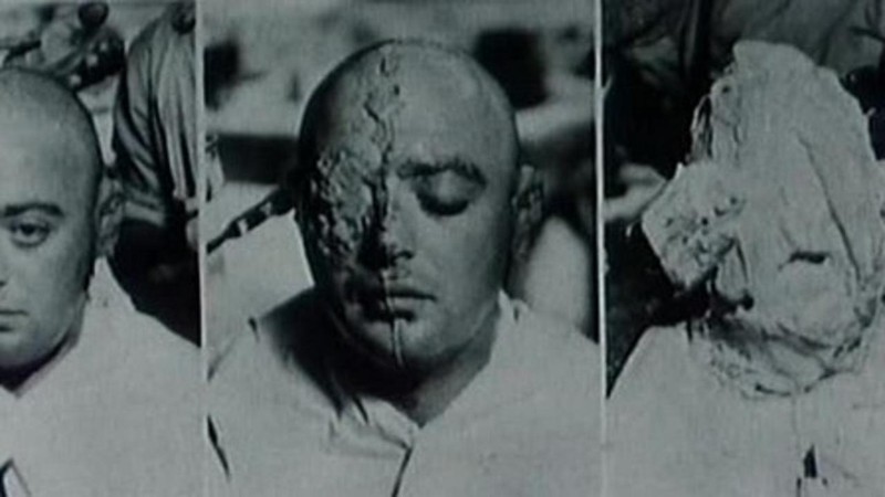 The Double Face of Peter Lorre